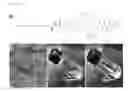 Fig. 08 - Device and method to treat esophageal disorders
