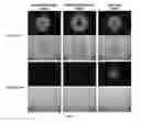 Fig. 07 - Human type 55 replication defective adenovirus vector, method for preparing same and uses thereof