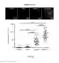 Fig. 29 - Lipid-polymer Hybrid Nanoparticle Biochip and Application Thereof
