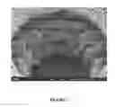 Fig. 03 - METHOD FOR ELECTROLESS PLATING