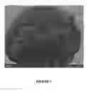 Fig. 06 - METHOD FOR ELECTROLESS PLATING