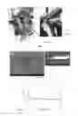 Fig. 03 - Method of forming local nano/micro size structures of anodized metal