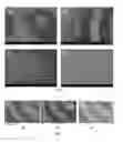 Fig. 04 - Method of forming local nano/micro size structures of anodized metal