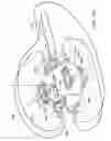 Fig. 20 - Altering characteristics of a wellbore by mechanical intervention at the source