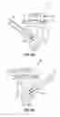 Fig. 07 - Injector including swirl device