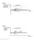 Fig. 04 - Clogging degree estimation apparatus