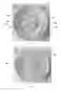 Fig. 07 - Fluid pump with pulse reduction