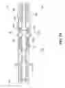 Fig. 03 - Isolating a downhole-type electric machine