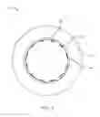 Fig. 07 - Floating rotor disc brake with marcel expander ring attachment