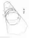 Fig. 10 - Valve insert