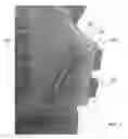 Fig. 08 - Body Armor