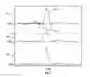 Fig. 07 - Extending the range of a MEMS gyroscope using eccentric accelerometers