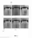Fig. 05 - System and method for detecting halitosis