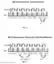 Fig. 07 - Immunoassay with enhanced sensitivity