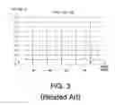 Fig. 04 - Method and apparatus for calculating offset of wheatstone bridge type sensor