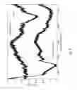 Fig. 12 - Supercontinuum light source comprising microstructured optical fiber