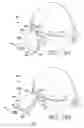 Fig. 14 - Interchangeable optics for a head-mounted display