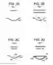 Fig. 03 - INCREASED STIFFNESS CENTER OPTIC IN SOFT CONTACT LENSES FOR ASTIGMATISM CORRECTION