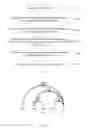 Fig. 02 - Method and device for clarifying questions on deep question and answer