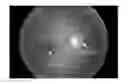 Fig. 01 - Methods and systems for assessing retinal images, and obtaining information from retinal images