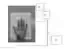 Fig. 01 - Method and system for imaging and analysis of anatomical features