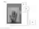 Fig. 02 - Method and system for imaging and analysis of anatomical features