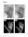 Fig. 12 - Method and system for imaging and analysis of anatomical features