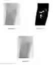 Fig. 13 - Method and system for imaging and analysis of anatomical features
