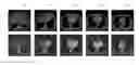 Fig. 01 - 3D segmentation reconstruction from 2D slices