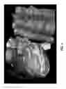 Fig. 04 - 3D segmentation reconstruction from 2D slices