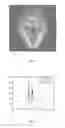 Fig. 06 - Spectral CT image reconstructing method and spectral CT imaging system