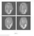 Fig. 09 - Spectral CT image reconstructing method and spectral CT imaging system
