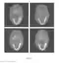 Fig. 10 - Spectral CT image reconstructing method and spectral CT imaging system