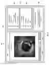 Fig. 09 - Interactive intravascular procedure training and associated devices, systems, and methods