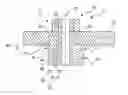 Fig. 01 - ROTATING ANODE MOUNT ADAPTIVE TO THERMAL EXPANSION