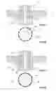 Fig. 03 - ROTATING ANODE MOUNT ADAPTIVE TO THERMAL EXPANSION