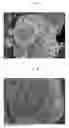 Fig. 02 - Positive electrode active material particle powder for non-aqueous electrolyte secondary battery, method for producing same, and non-aqueous electrolyte secondary battery