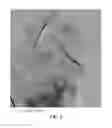 Fig. 06 - Process for Flexible and Shape-Conformal Cable-Shape Alkali Metal-Sulfur Batteries