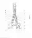 Fig. 05 - CABLE STRESS RELIEVER