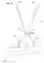 Fig. 06 - Overvoltage protection for power systems