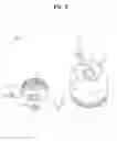 Fig. 09 - Ear unit and portable sound device