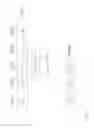 Fig. 02 - Methods and arrangements in a mobile telecommunication system