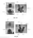 Fig. 06 - Swirl ring for a plasma arc torch