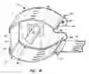 Fig. 17 - Insect light trap with extruded curved side panels and curved glue board