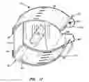 Fig. 18 - Insect light trap with extruded curved side panels and curved glue board