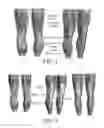 Fig. 02 - Leg-protecting apparatus having dynamic biological function