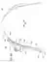 Fig. 45 - Apparatus including a quick-release fastener and pull cord