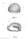 Fig. 02 - Laterally supported filaments