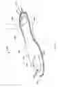 Fig. 49 - Non-slip Removable Footwear Insert