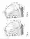 Fig. 09 - Vacuum cleaner